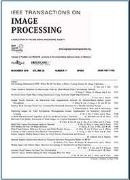 IEEE Transactions on Image Processing